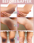 Whitening Cream Intimate Parts Dark Remove Melanin