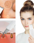 Skin Scrubber Deep Vibrate Facial Cleaner