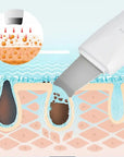 Skin Scrubber Deep Vibrate Facial Cleaner