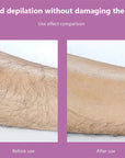 Crystal Physical Hair Removal